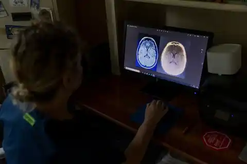 Imagen 1 de Investigación revela que la cocaína reestructura el cerebro