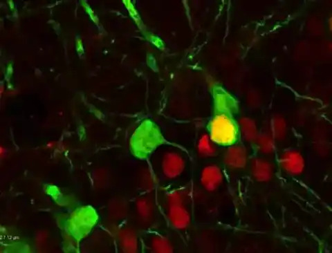 Imagen 1 de Estudio revela que la cocaína reconfigura el cerebro y causa
