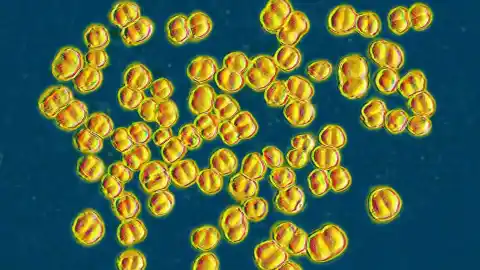 Imagen 1 de Inglaterra registra 29 casos de meningitis B mortal con dos
