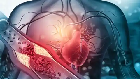 Imagen 1 de Cardiólogo advierte que delgadez no asegura colesterol