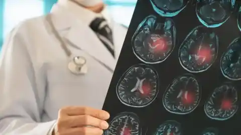 Imagen 1 de Doctor Bueno advierte que el hormigueo matutino en manos