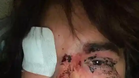Imagen 1 de Bianca Lizbeth Fernández denuncia paliza grupal en La Bañeza