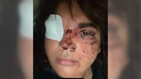 Imagen 1 de Mujer trans recibe paliza brutal de diez personas