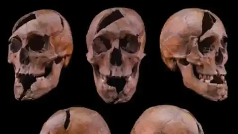 Imagen 1 de El horroroso asesinato de un duque medieval húngaro que quedó gravemente mutilado y que ha necesitado 750 años para resolverse