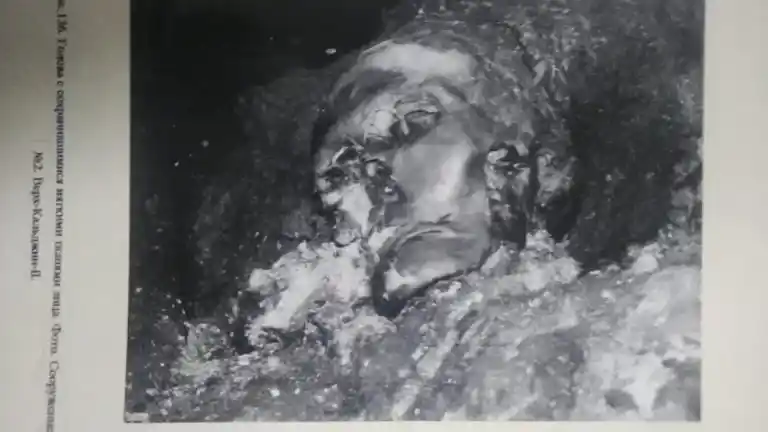 Imagen 1 de Una mujer de Siberia, hace 2.500 años, fue la primera en recibir una prótesis bucal en la historia.